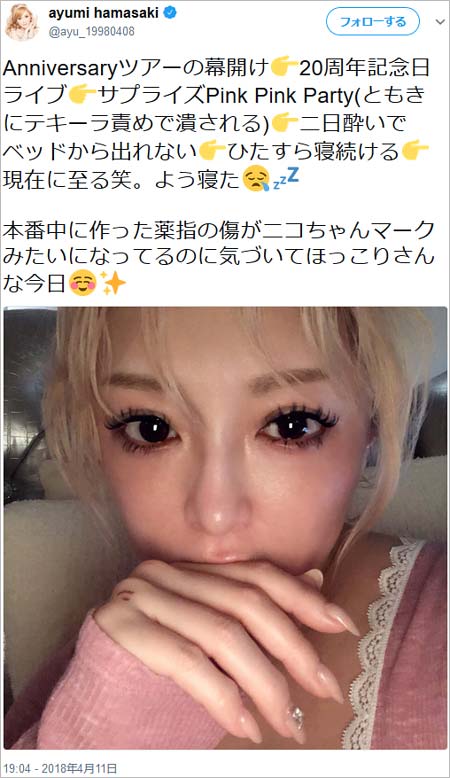 浜崎あゆみの二日酔いツイート