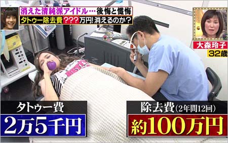 大森玲子がタトゥー除去手術