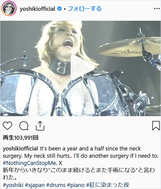 YOSHIKIのインスタグラム投稿写真