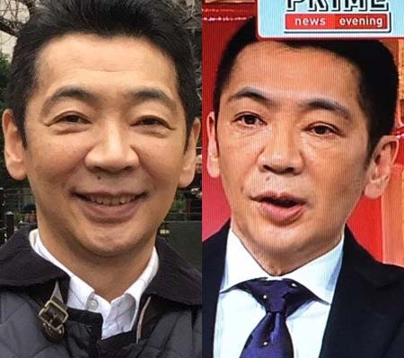 宮根誠司のプチ整形前と後