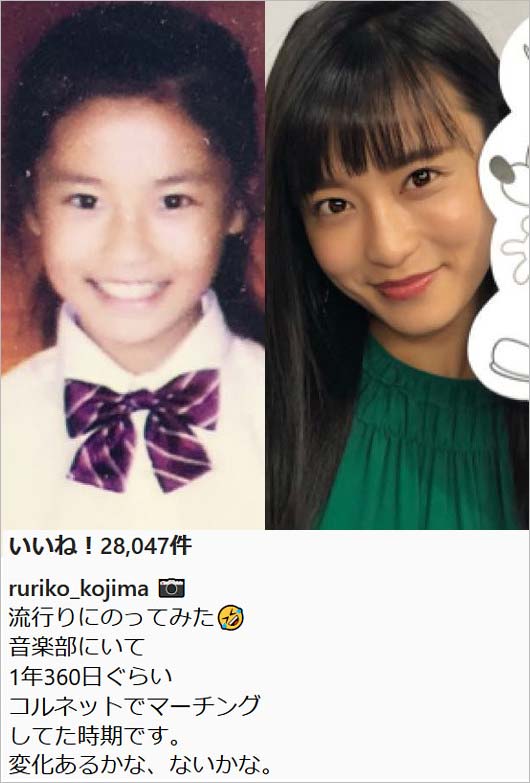 小島瑠璃子の昔と現在の顔画像