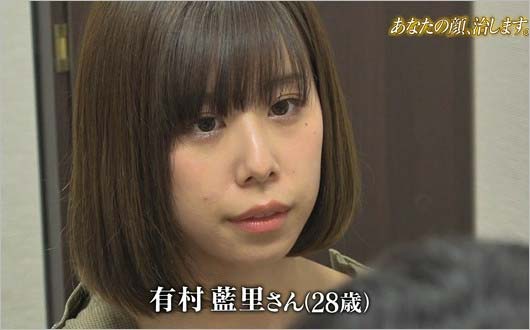 ザ・ノンフィクション出演の有村藍里(整形前)