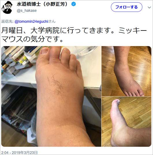 水道橋博士の浮腫ツイート