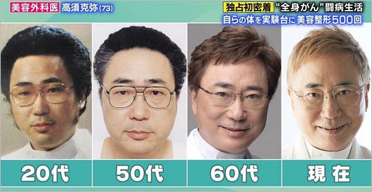 高須克弥の整形手術・顔の変化
