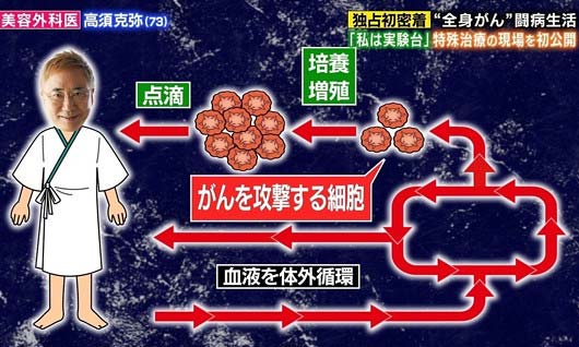 高須克弥のガン治療2枚目