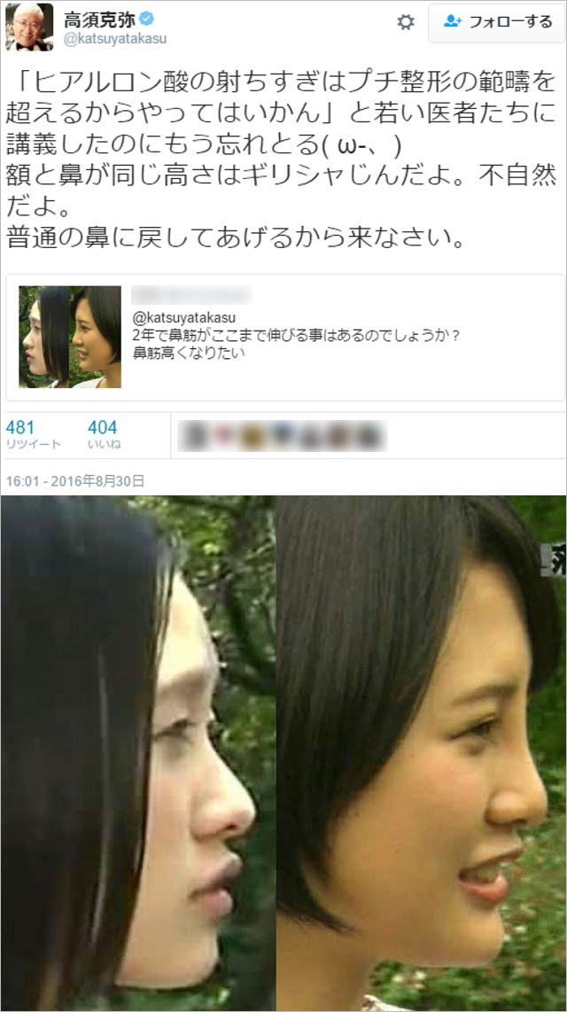 高須克弥院長の兒玉遥の整形指摘ツイート