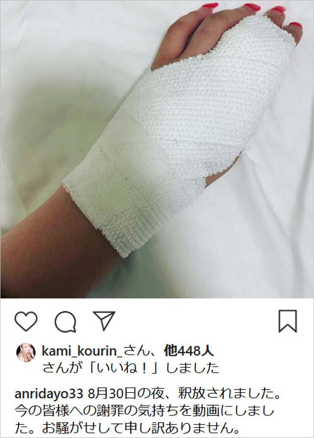 坂口杏里の手負傷インスタ画像
