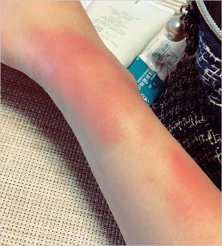 守屋功輝投手が妻にDV疑惑、証拠の被害写真