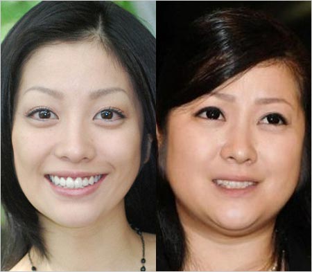 小向美奈子が激太り前と激太り&整形後の顔写真比較