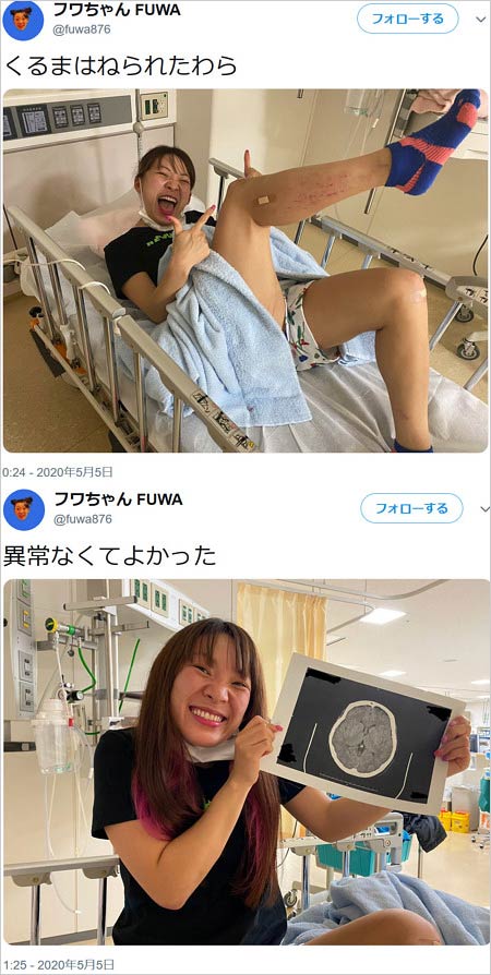 フワちゃんが交通事故を報告ツイート