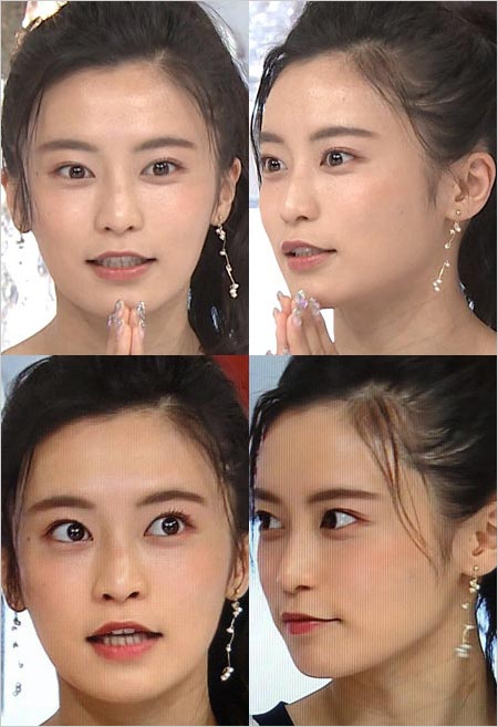 おしゃれイズム出演時の小島瑠璃子、美容整形疑惑の検証写真