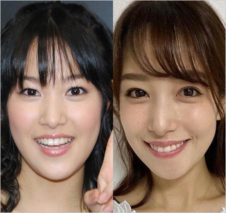 元テレビ東京・鷲見玲奈アナの昔と現在の顔、整形疑惑の検証比較写真