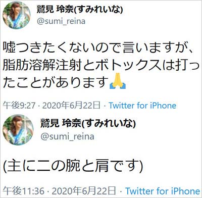 鷲見玲奈アナウンサーが顔の美容施術・治療を告白ツイート