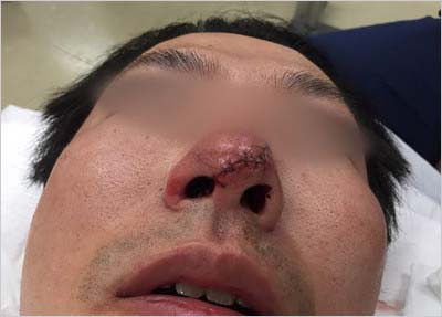 陣内孝則の息子にケガさせられたH氏の顔