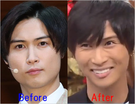 A.B.C-Z橋本良亮の激やせ前と現在の激ヤセ後の顔写真