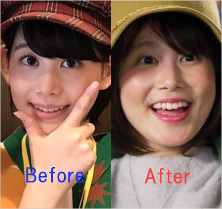 金城茉奈（龍井うい）が激太りする前と後のビフォー・アフター