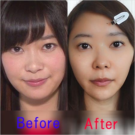 指原莉乃の顔整形疑惑、スッピンと昔の写真比較