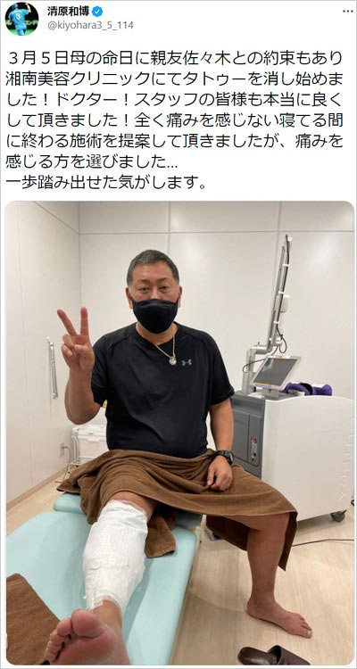 清原和博が刺青除去施術開始報告