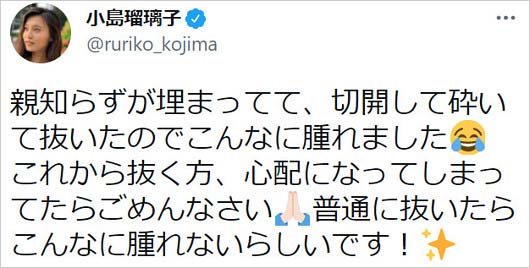 小島瑠璃子が親知らず抜歯報告ツイート