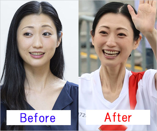 壇蜜が激ヤセ前後のビフォーアフター画像