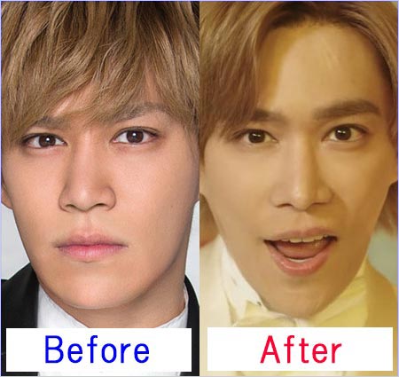 千賀健永の鼻整形前と後ビフォー・アフター画像