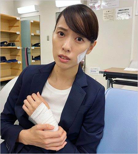 戸田恵梨香が激ヤセ、頬がコケている画像