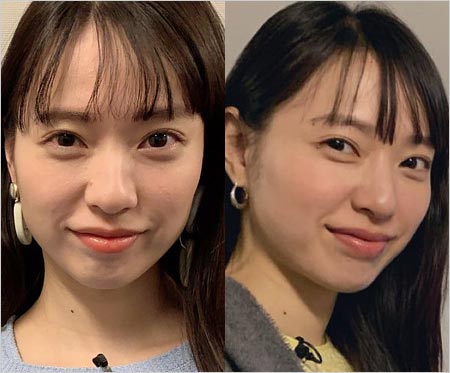 戸田恵梨香が激ヤセ前の顔画像