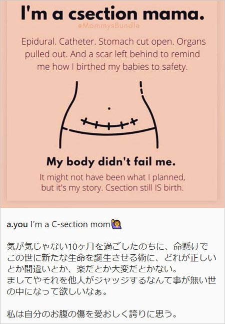 浜崎あゆみ帝王切開公表インスタグラム画像