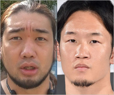 シバターと朝倉未来選手