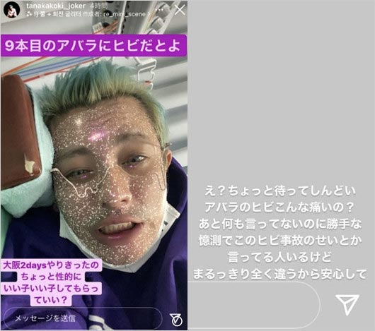 田中聖が肋骨骨折インスタストーリー画像