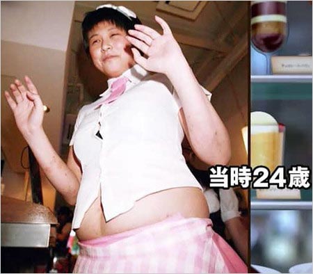 小阪由佳がうつ病、激太り時代の画像