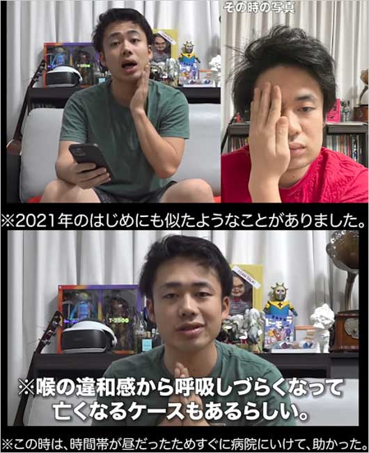 Fischer’sシルクロードの急性扁桃腺炎を明かした動画画像