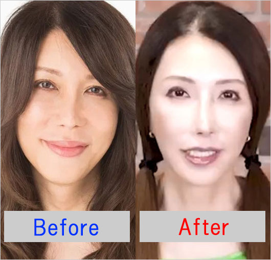 KABA.ちゃんダイエット前と現在の顔ビフォーアフター画像