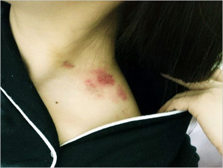 ORβIT・TOMOの彼女のアザ