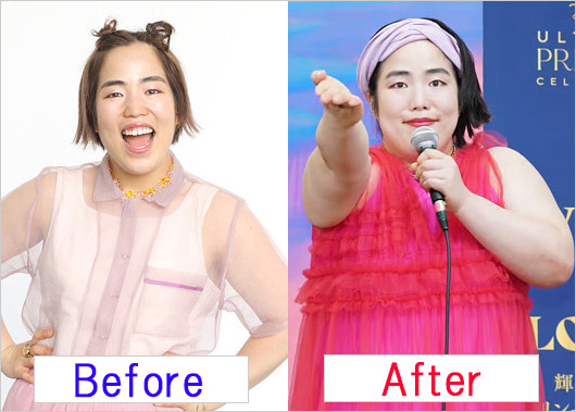 ゆりやんレトリィバァ激太り・役作りで太る前と後のビフォーアフター画像