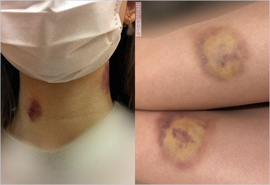 元宇宙Six山本亮太の元彼女のDV被害証拠画像