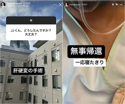 ジャガー横田の息子・木下大維志が肝硬変の手術とウソのインスタストーリー画像