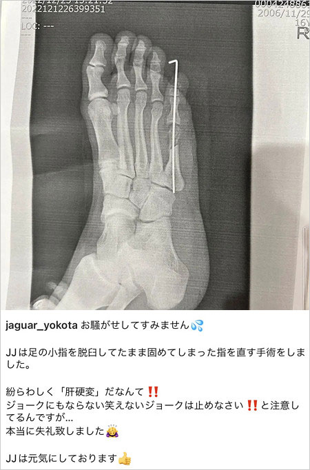 ジャガー横田が大維志の肝硬変手術を否定のインスタグラム画像