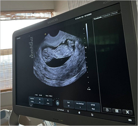 大坂なおみ赤ちゃんのエコー写真