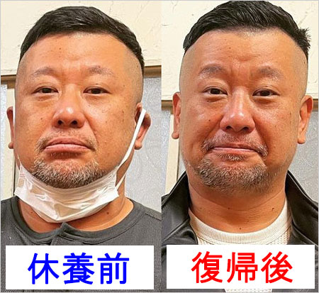 ケンドーコバヤシ休養前と復帰後のビフォーアフター画像