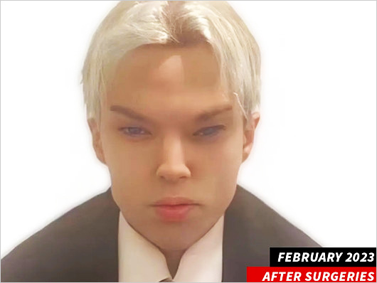 カナダ人俳優セイント・フォン・コルッチがBTSジミンに似せ整形後の画像