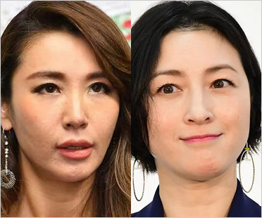 鈴木紗理奈・広末涼子