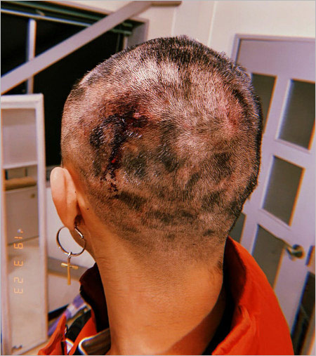 キャンドル・ジュン暴行被害の元スタッフ