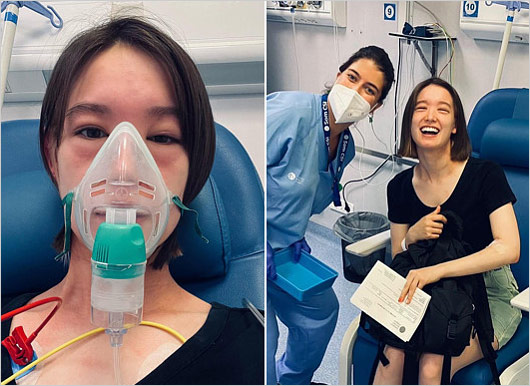 トラウデン直美が着力料アレルギーによるアナフィラキシーショックで治療前と治療後の画像