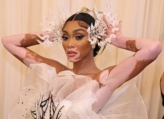 ウィニー・ハーロウ 尋常性白斑のモデルWinnie Harlow