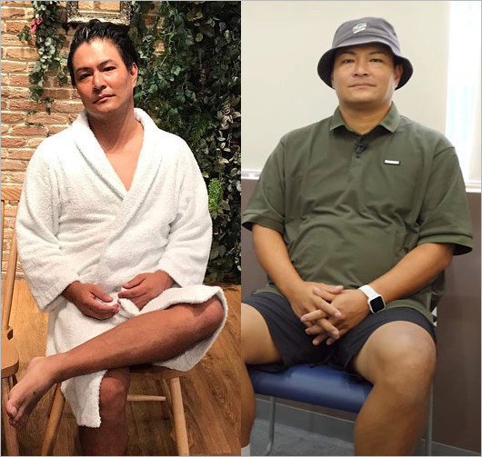 天竺鼠・瀬下豊のビフォー・アフター画像