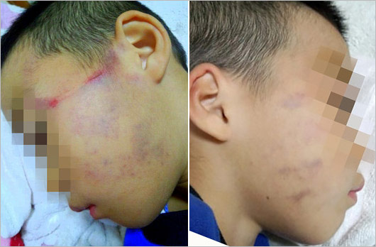 吉田沙保里の兄の体罰・虐待問題の証拠画像