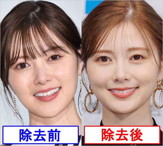 白石麻衣がホクロ除去施術前後の顔比較画像