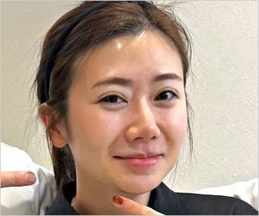 整形後の福原愛