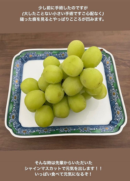 渡邊渚アナが手術報告のインスタストーリー画像